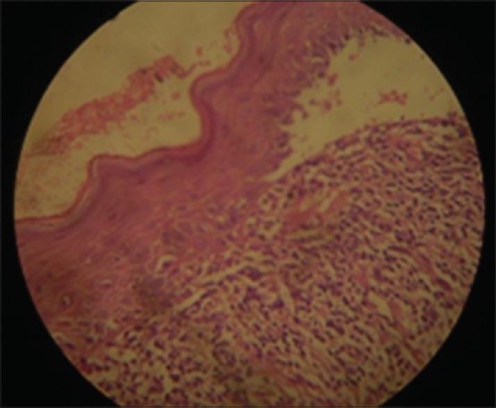 https://cdn.ncbi.nlm.nih.gov/pmc/blobs/d489/6482806/e89b21f994b2/JFMPC-8-1269-g002.jpg
