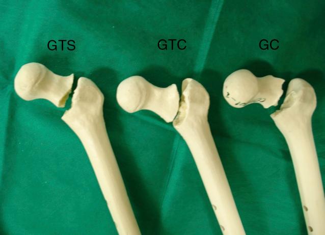 https://cdn.ncbi.nlm.nih.gov/pmc/blobs/d48b/5620003/bbb95c0c3269/gr4.jpg