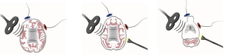 https://cdn.ncbi.nlm.nih.gov/pmc/blobs/d48d/5343068/c6d90503c07d/fncir-11-00015-g0001.jpg