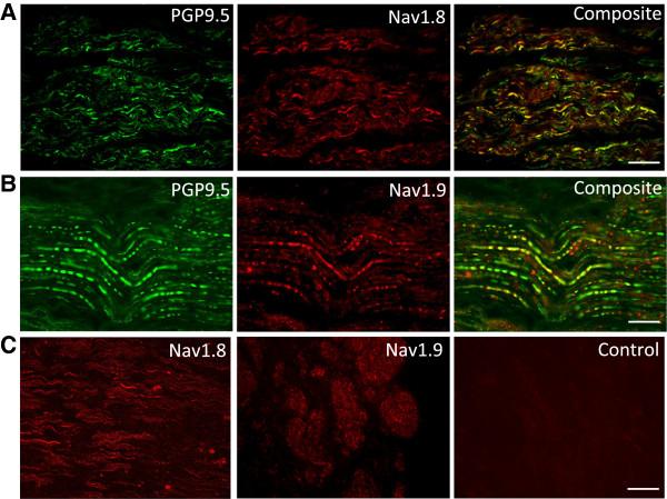 https://cdn.ncbi.nlm.nih.gov/pmc/blobs/d490/4016210/e19b6e2651e5/1744-8069-9-52-1.jpg