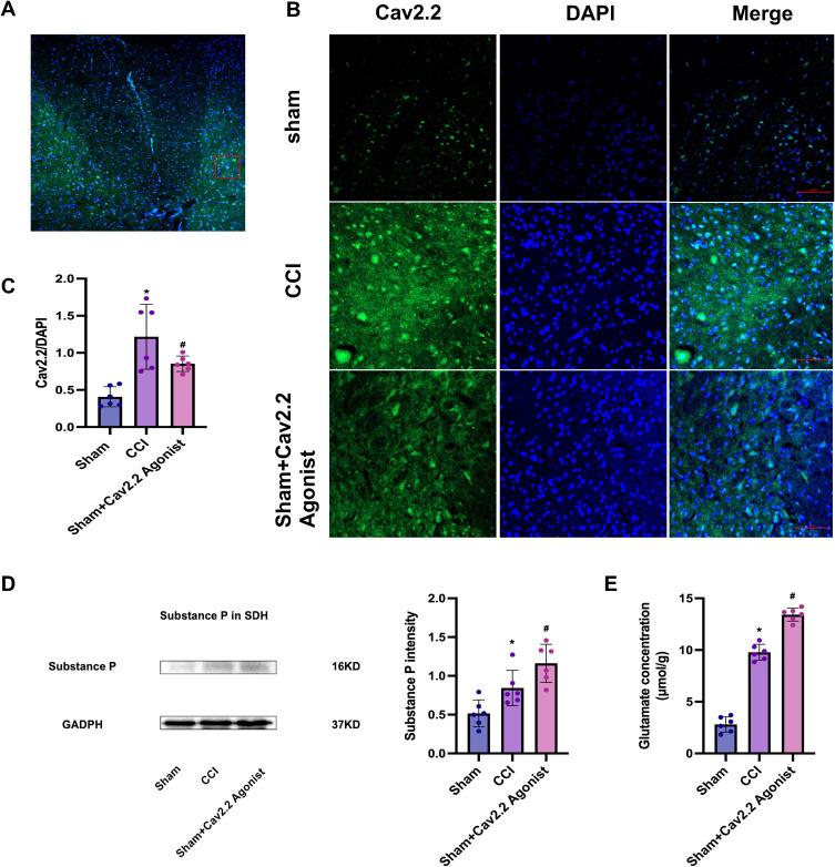 https://cdn.ncbi.nlm.nih.gov/pmc/blobs/d49d/12149277/42efa7b66055/JPR-18-2775-g0004.jpg