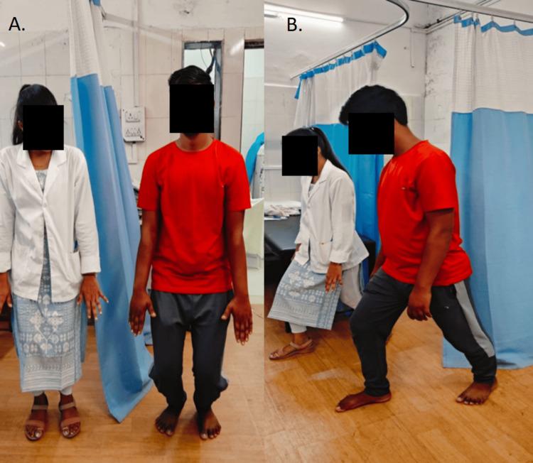 https://cdn.ncbi.nlm.nih.gov/pmc/blobs/d4a7/11228404/1f52c5e9d6a8/cureus-0016-00000061868-i03.jpg