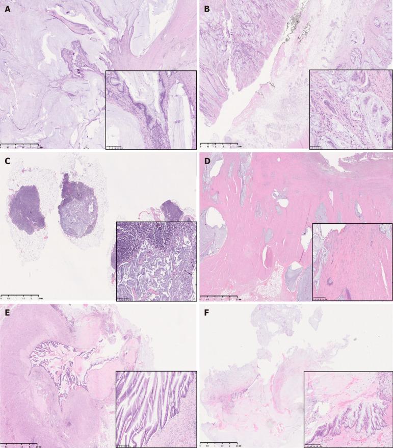 https://cdn.ncbi.nlm.nih.gov/pmc/blobs/d4a8/12305226/9ee356ccd7af/wjgs-17-7-106672-g001.jpg
