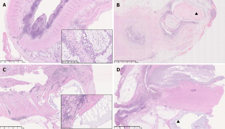 https://cdn.ncbi.nlm.nih.gov/pmc/blobs/d4a8/12305226/c23c35aad257/wjgs-17-7-106672-g002.jpg