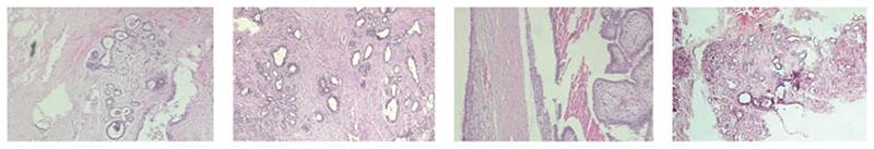 https://cdn.ncbi.nlm.nih.gov/pmc/blobs/d4a8/7614504/752ffb2f3451/EMS174792-f002.jpg