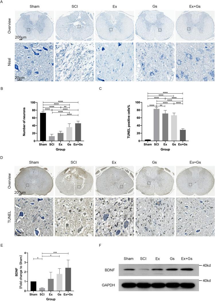 https://cdn.ncbi.nlm.nih.gov/pmc/blobs/d4a9/11753701/a507577a85a7/pone.0317683.g004.jpg