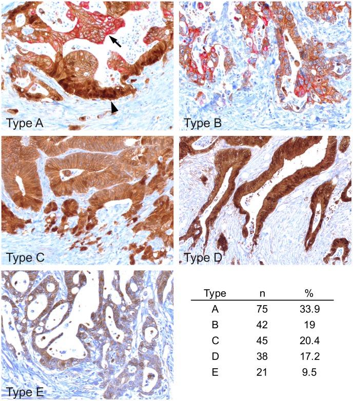 https://cdn.ncbi.nlm.nih.gov/pmc/blobs/d4a9/4128715/63aad7353e2e/pone.0104284.g003.jpg