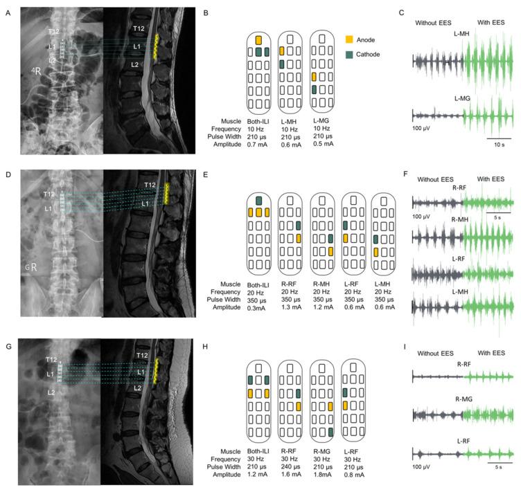 https://cdn.ncbi.nlm.nih.gov/pmc/blobs/d4af/11762847/1a50f0231948/biomedicines-13-00155-g003.jpg