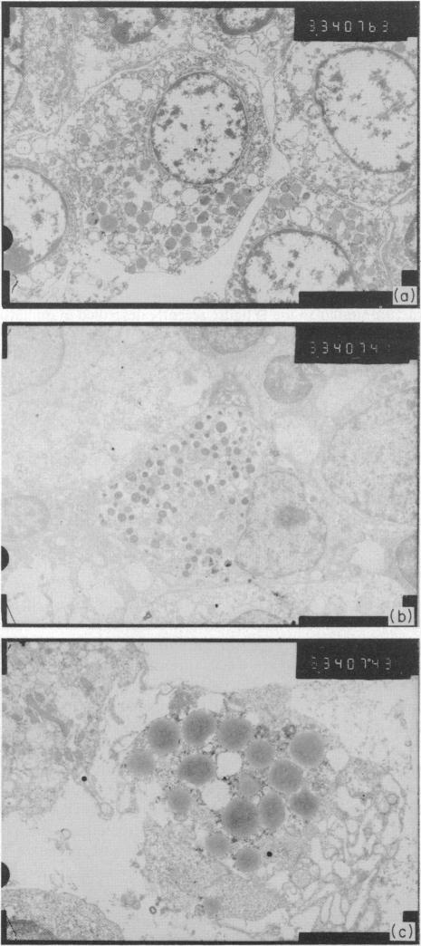 https://cdn.ncbi.nlm.nih.gov/pmc/blobs/d4b0/1453322/a6b388e46cc9/immunology00177-0072-a.jpg