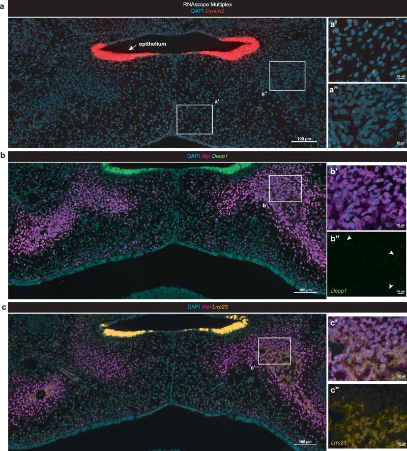 https://cdn.ncbi.nlm.nih.gov/pmc/blobs/d4b2/10502152/d7aad96f7011/41467_2023_41349_Fig7_HTML.jpg