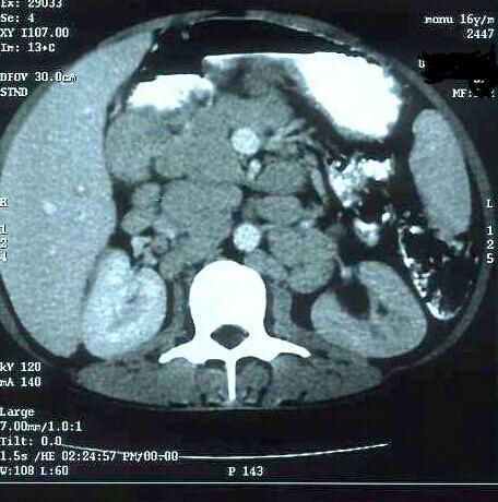 https://cdn.ncbi.nlm.nih.gov/pmc/blobs/d4b3/6346787/510002501dc2/605_Fig1.jpg