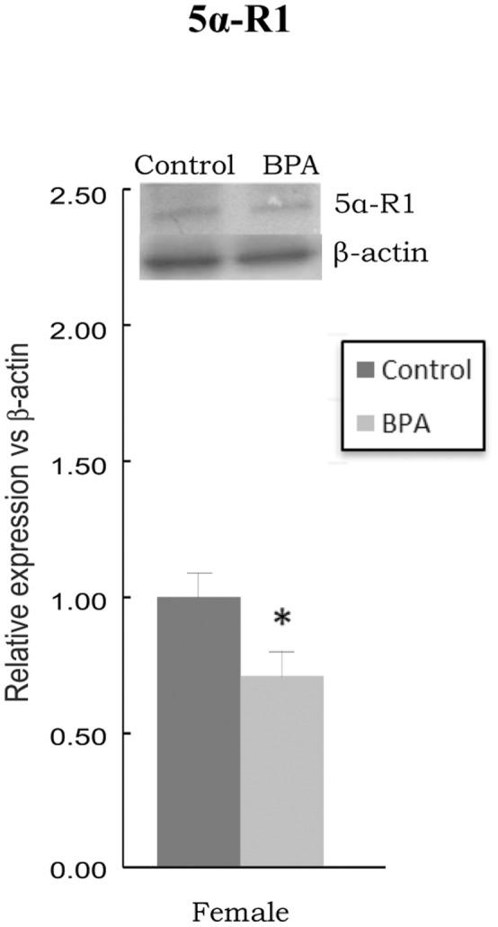 https://cdn.ncbi.nlm.nih.gov/pmc/blobs/d4bc/3774751/2b897a25f24c/pone.0073584.g002.jpg