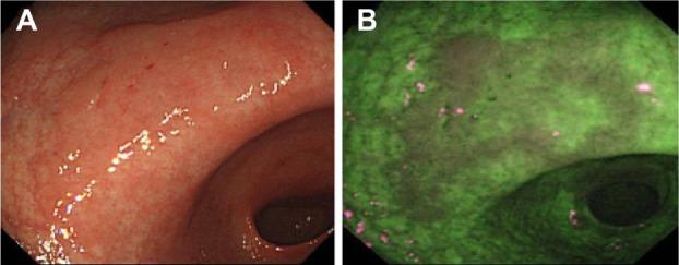 https://cdn.ncbi.nlm.nih.gov/pmc/blobs/d4c2/4028486/971752c5437e/ceg-7-133Fig5.jpg