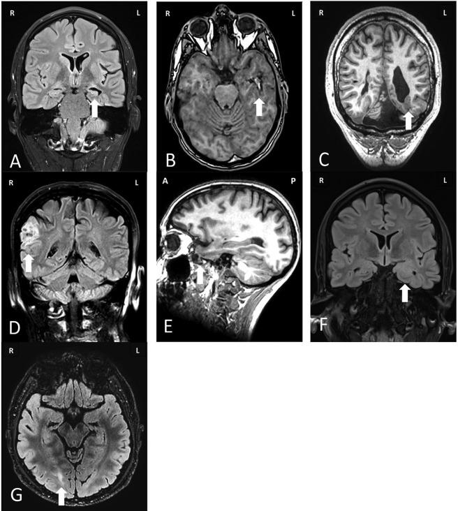 https://cdn.ncbi.nlm.nih.gov/pmc/blobs/d4c9/5947666/45768ac34ef5/ANA-83-676-g001.jpg