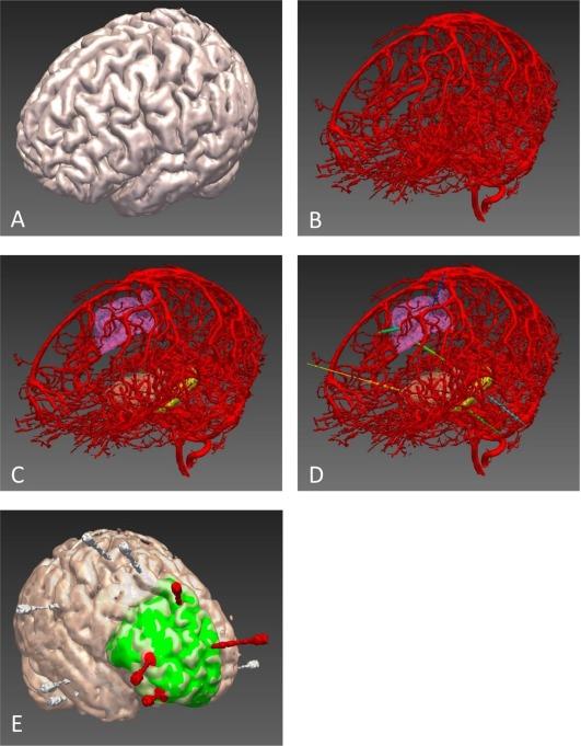https://cdn.ncbi.nlm.nih.gov/pmc/blobs/d4c9/5947666/b204b2fd478d/ANA-83-676-g002.jpg