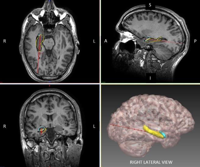 https://cdn.ncbi.nlm.nih.gov/pmc/blobs/d4c9/5947666/f8f4c3dbdde3/ANA-83-676-g003.jpg
