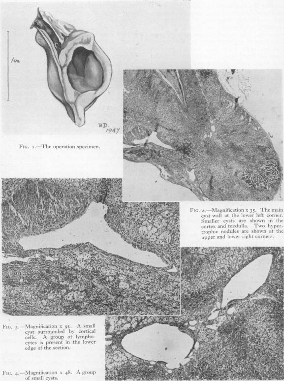 https://cdn.ncbi.nlm.nih.gov/pmc/blobs/d4cf/2529620/06b543a0d1d7/postmedj00636-0030-a.jpg