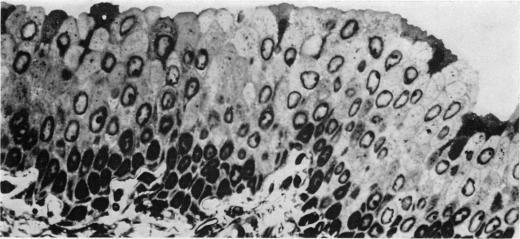 https://cdn.ncbi.nlm.nih.gov/pmc/blobs/d4d3/2011196/06fdabc965c9/brjcancer00433-0129-a.jpg