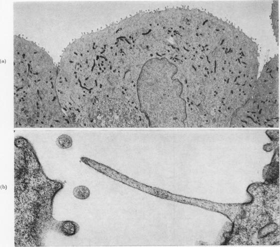 https://cdn.ncbi.nlm.nih.gov/pmc/blobs/d4d3/2011196/29072261d1cb/brjcancer00433-0136-a.jpg