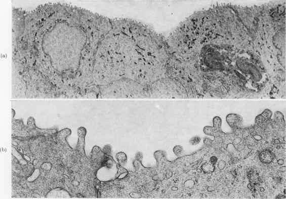 https://cdn.ncbi.nlm.nih.gov/pmc/blobs/d4d3/2011196/bd5a3fab8a48/brjcancer00433-0131-a.jpg