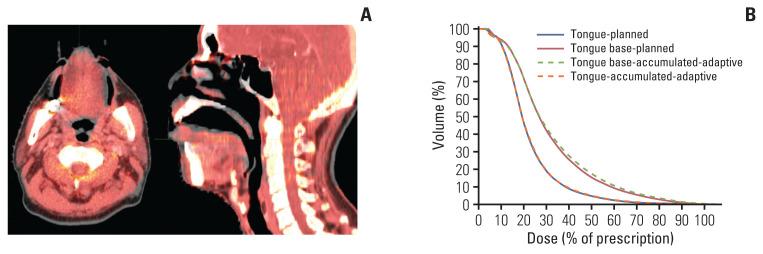 https://cdn.ncbi.nlm.nih.gov/pmc/blobs/d4d6/7812000/84f3469706a5/crt-2020-572f4.jpg