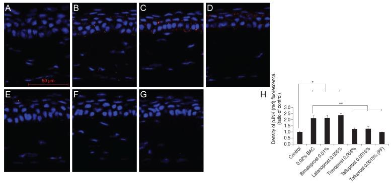 https://cdn.ncbi.nlm.nih.gov/pmc/blobs/d4df/4520871/6a12e95598d5/kjo-29-270-g006.jpg