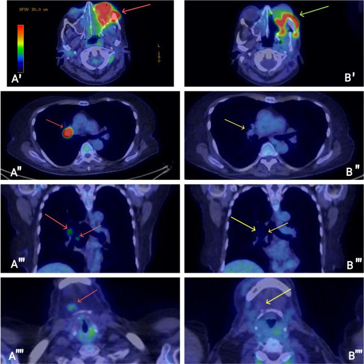 https://cdn.ncbi.nlm.nih.gov/pmc/blobs/d4e6/11458888/cc977e633b35/CNR2-7-e70023-g001.jpg