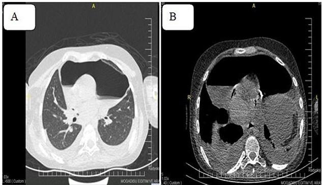 https://cdn.ncbi.nlm.nih.gov/pmc/blobs/d4e8/9393189/44eb045c7250/rjac380f4.jpg