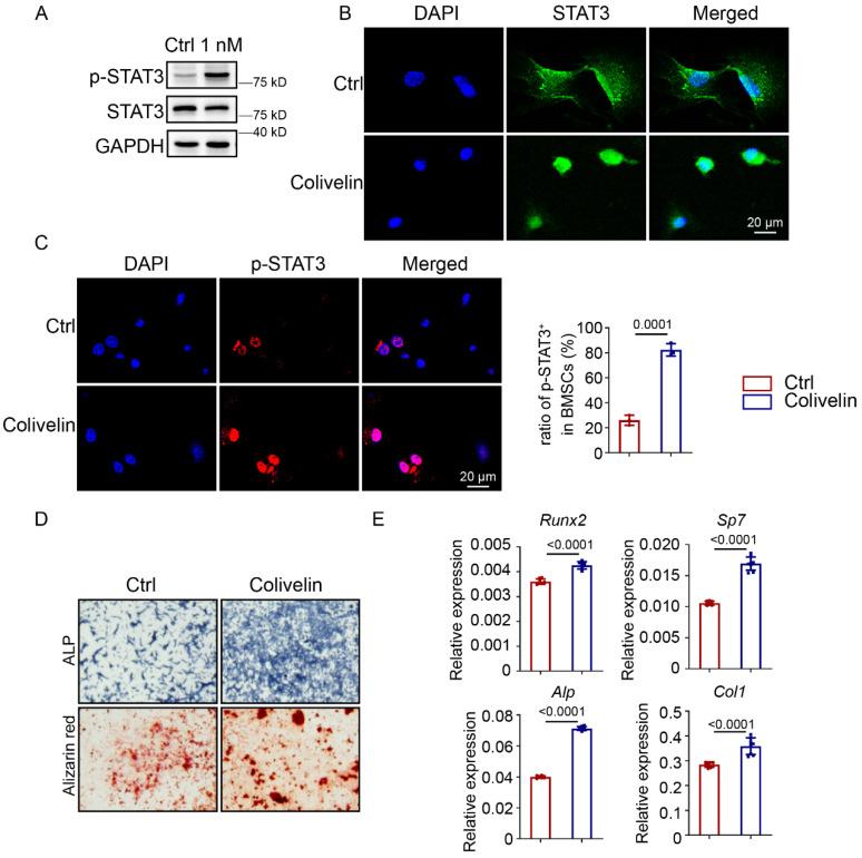 https://cdn.ncbi.nlm.nih.gov/pmc/blobs/d4ea/10158023/7fb8dcaf0c50/ijbsv19p2021g005.jpg