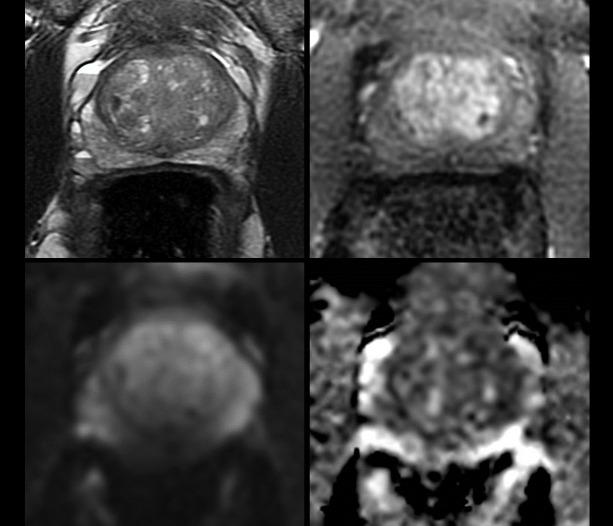 https://cdn.ncbi.nlm.nih.gov/pmc/blobs/d4f3/10993954/2703a5cd1c97/bjr.20211372.g008.jpg