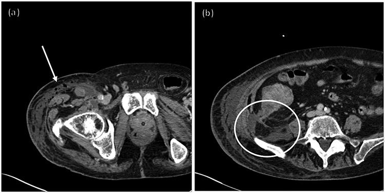 https://cdn.ncbi.nlm.nih.gov/pmc/blobs/d4f5/7655015/a021ef2a1a4f/rjaa371f1.jpg