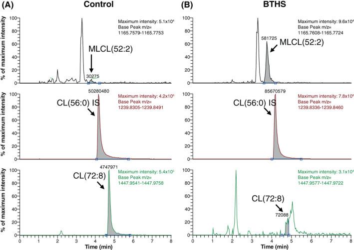 https://cdn.ncbi.nlm.nih.gov/pmc/blobs/d4f6/9291596/4b05375fa032/JIMD-45-29-g002.jpg