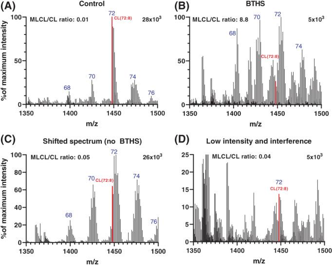https://cdn.ncbi.nlm.nih.gov/pmc/blobs/d4f6/9291596/4f12fb69dc0d/JIMD-45-29-g003.jpg