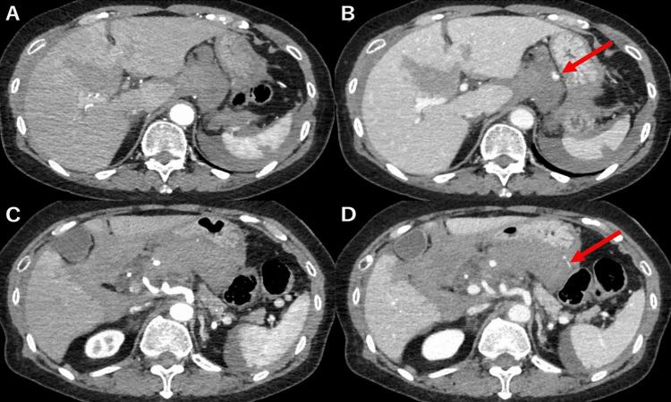 https://cdn.ncbi.nlm.nih.gov/pmc/blobs/d4f9/10767424/41504a97cee4/cureus-0015-00000050018-i01.jpg