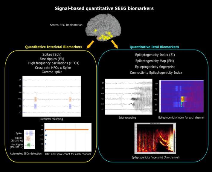 https://cdn.ncbi.nlm.nih.gov/pmc/blobs/d4fd/12014933/a1a3d83a1512/EPI4-10-380-g002.jpg