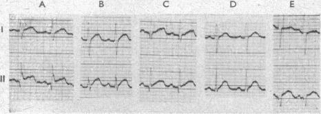 https://cdn.ncbi.nlm.nih.gov/pmc/blobs/d504/1990332/59a36c9f8edc/brmedj02937-0036-a.jpg