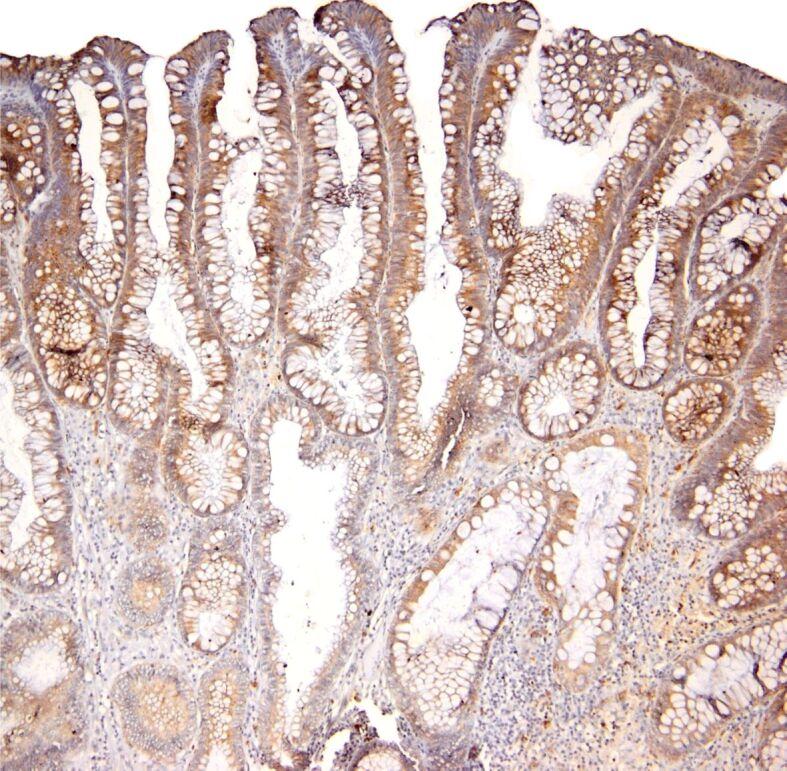 https://cdn.ncbi.nlm.nih.gov/pmc/blobs/d505/9289700/9314c37cf161/RJME-62-4-971-fig8.jpg