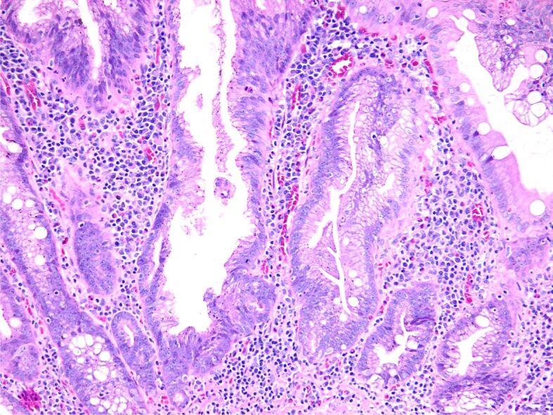 https://cdn.ncbi.nlm.nih.gov/pmc/blobs/d505/9289700/ac6a06911bdd/RJME-62-4-971-fig2.jpg