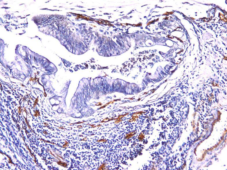 https://cdn.ncbi.nlm.nih.gov/pmc/blobs/d505/9289700/ec5bf8568b15/RJME-62-4-971-fig4.jpg