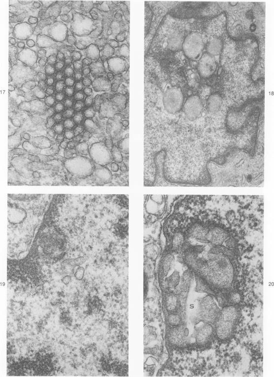 https://cdn.ncbi.nlm.nih.gov/pmc/blobs/d506/2042251/33c6c7d24111/amjpathol00246-0126-a.jpg