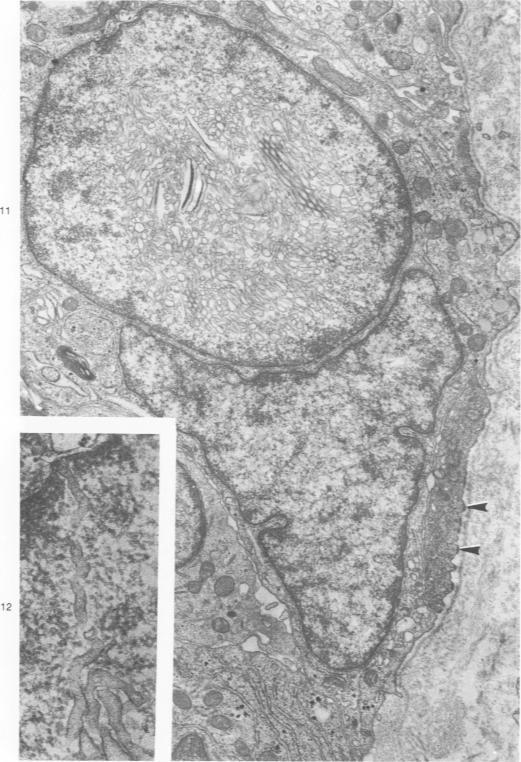 https://cdn.ncbi.nlm.nih.gov/pmc/blobs/d506/2042251/55676a399a96/amjpathol00246-0123-a.jpg