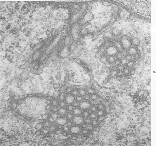 https://cdn.ncbi.nlm.nih.gov/pmc/blobs/d506/2042251/692b0f970556/amjpathol00246-0125-b.jpg