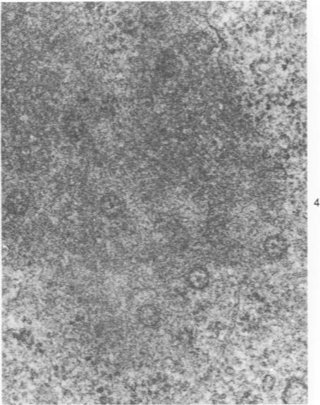 https://cdn.ncbi.nlm.nih.gov/pmc/blobs/d506/2042251/b336c7190927/amjpathol00246-0119-b.jpg