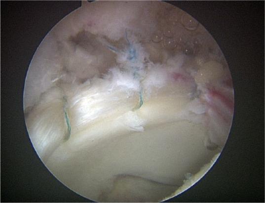 https://cdn.ncbi.nlm.nih.gov/pmc/blobs/d515/6129960/9da8106c95a6/eor-3-408-g005.jpg