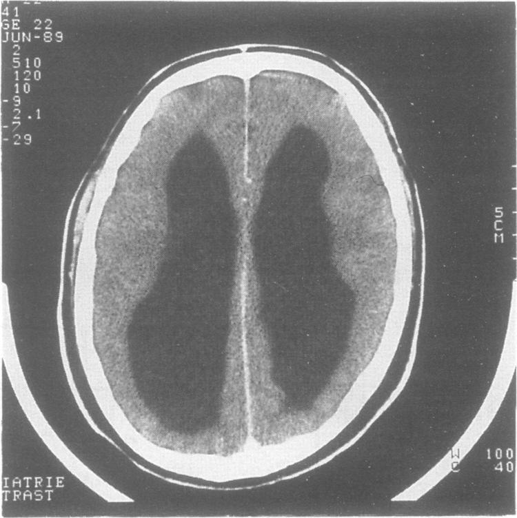 https://cdn.ncbi.nlm.nih.gov/pmc/blobs/d517/1017259/b3fea2467c32/jmedgene00049-0026-b.jpg