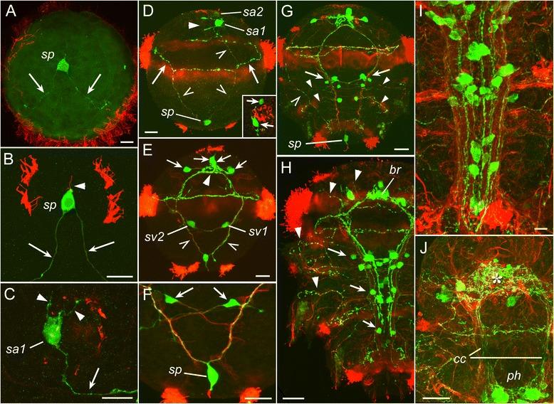 https://cdn.ncbi.nlm.nih.gov/pmc/blobs/d517/5445494/24e18c77f394/12983_2017_211_Fig4_HTML.jpg