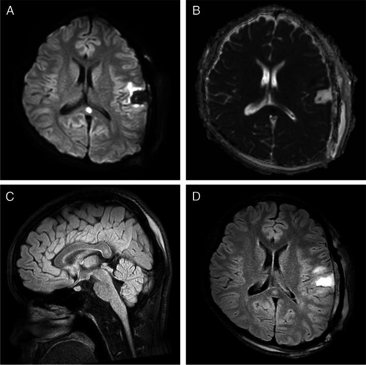 https://cdn.ncbi.nlm.nih.gov/pmc/blobs/d518/10101539/59033b7920be/701_2023_5573_Fig2_HTML.jpg