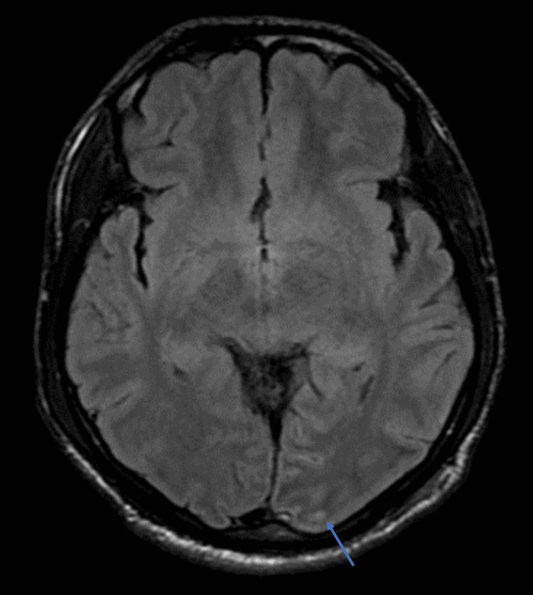 https://cdn.ncbi.nlm.nih.gov/pmc/blobs/d51b/10329843/66245b2415fc/cureus-0015-00000040182-i02.jpg