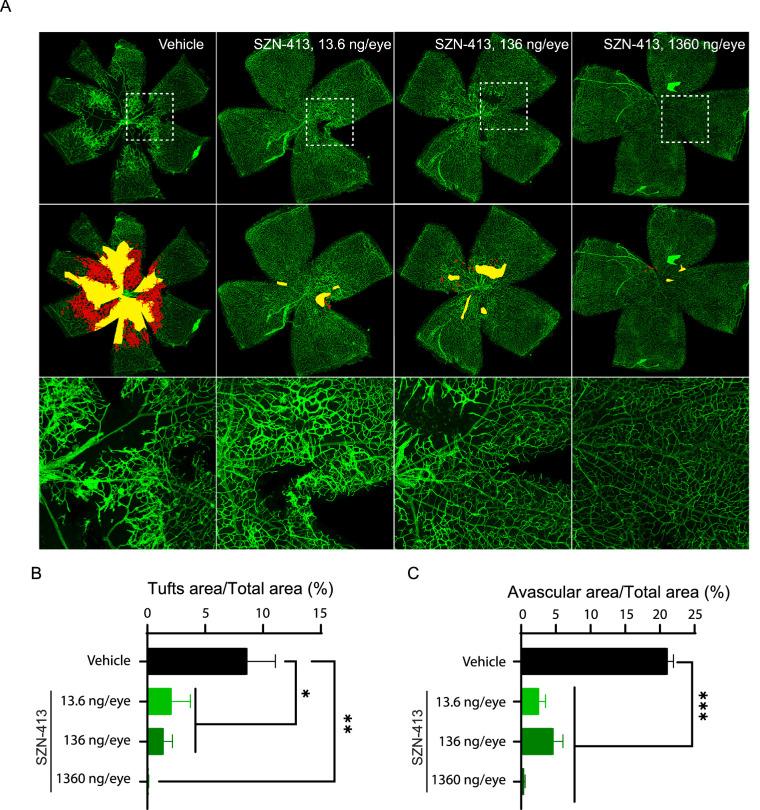 https://cdn.ncbi.nlm.nih.gov/pmc/blobs/d51c/9520515/79cd485bdacf/tvst-11-9-19-f005.jpg
