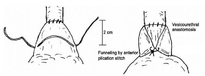 https://cdn.ncbi.nlm.nih.gov/pmc/blobs/d51e/4650455/43aae9d01ca0/AJA-17-304-g001.jpg